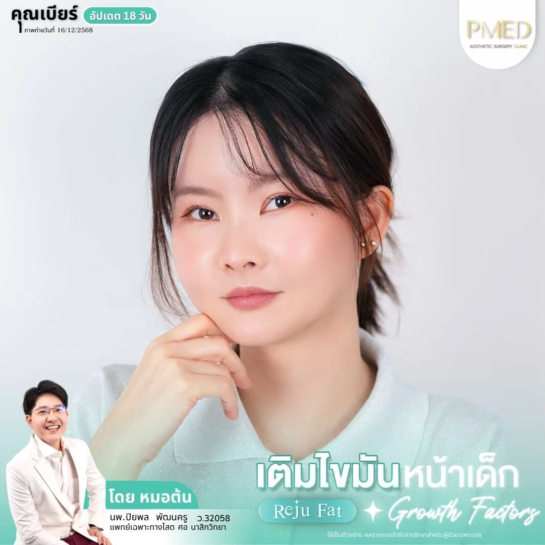LINE_ALBUM_เติมไขมัน Reju Fat ✨_260715_21