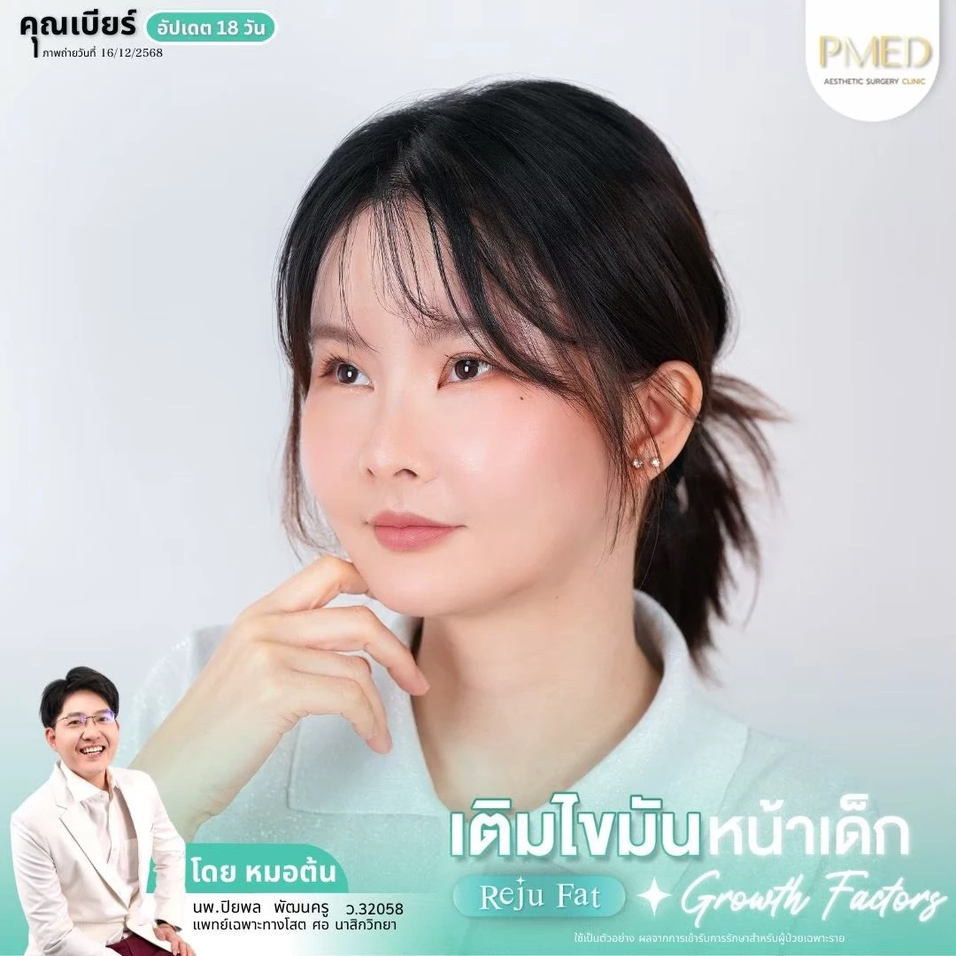 LINE_ALBUM_เติมไขมัน Reju Fat ✨_260715_22