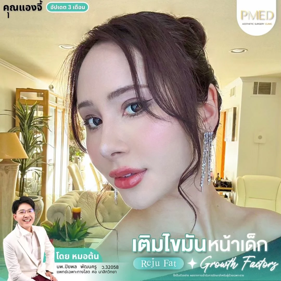 LINE_ALBUM_เติมไขมัน Reju Fat ✨_260715_27