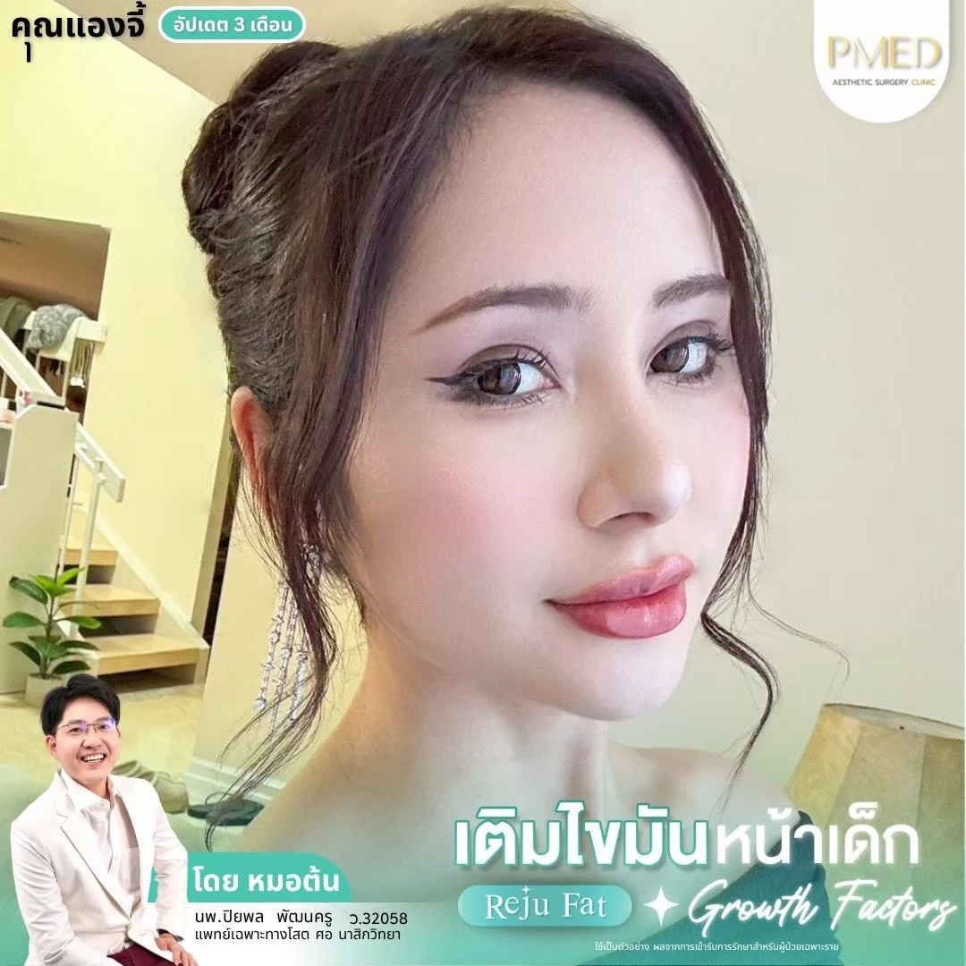 LINE_ALBUM_เติมไขมัน Reju Fat ✨_260715_28
