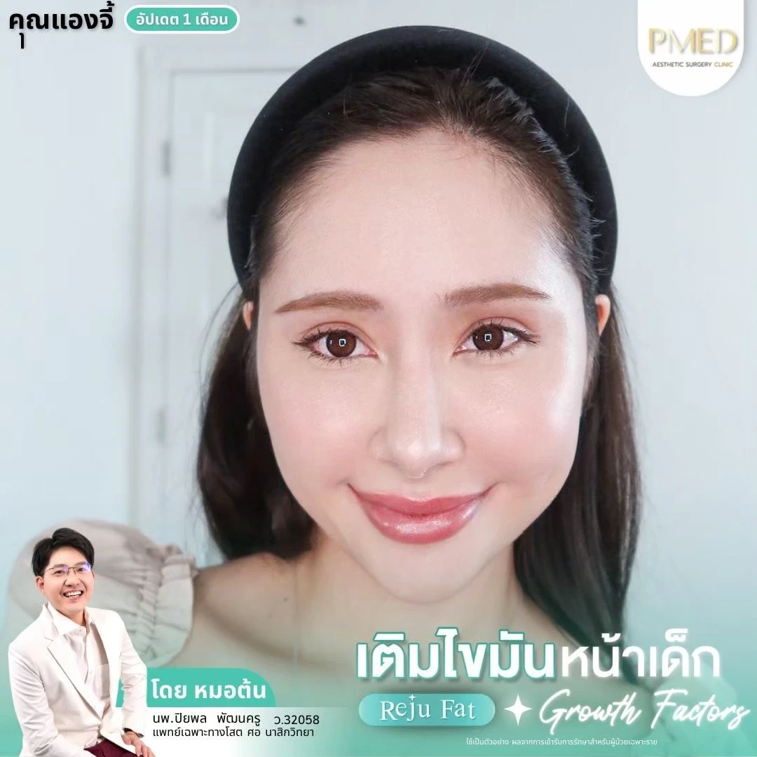 LINE_ALBUM_เติมไขมัน Reju Fat ✨_260715_29