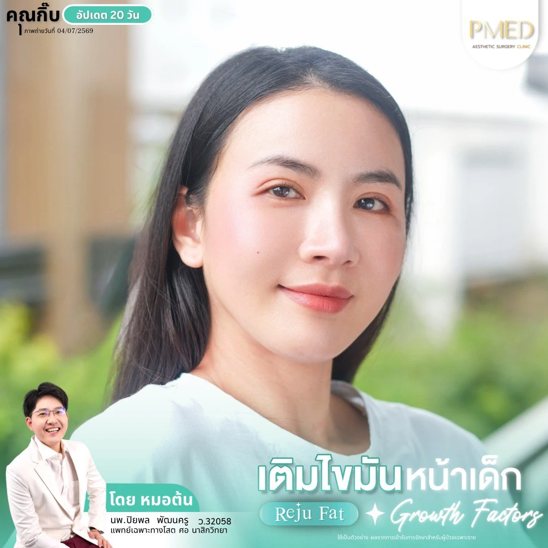 LINE_ALBUM_เติมไขมัน Reju Fat ✨_260715_3
