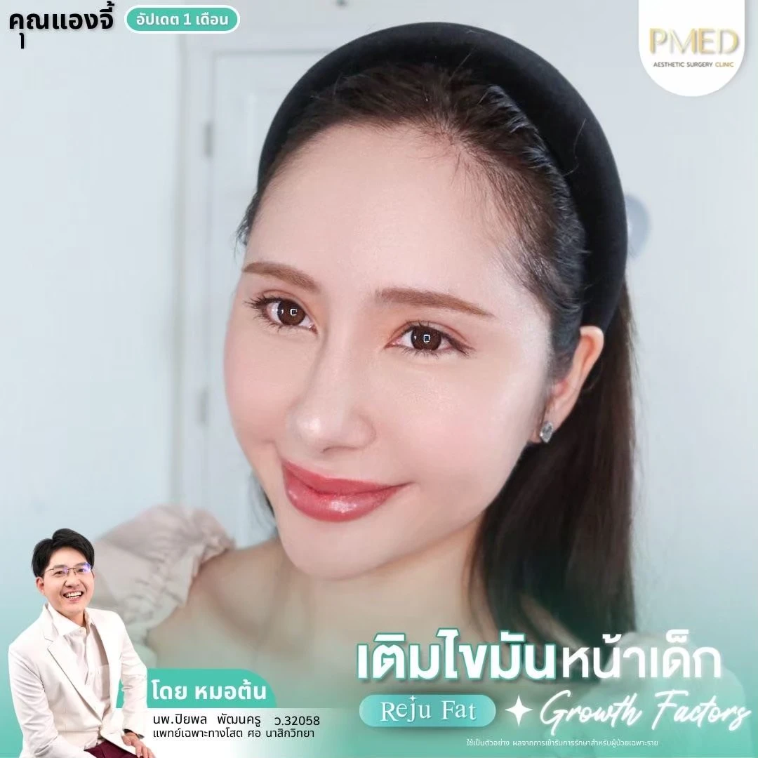 LINE_ALBUM_เติมไขมัน Reju Fat ✨_260715_30