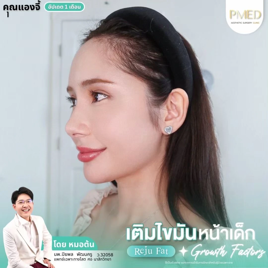 LINE_ALBUM_เติมไขมัน Reju Fat ✨_260715_31
