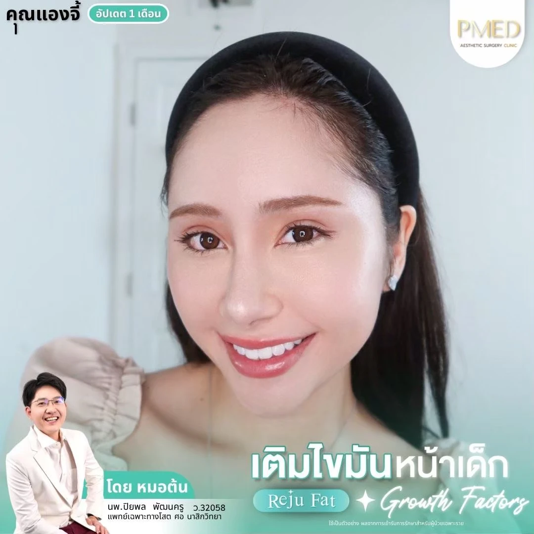 LINE_ALBUM_เติมไขมัน Reju Fat ✨_260715_32