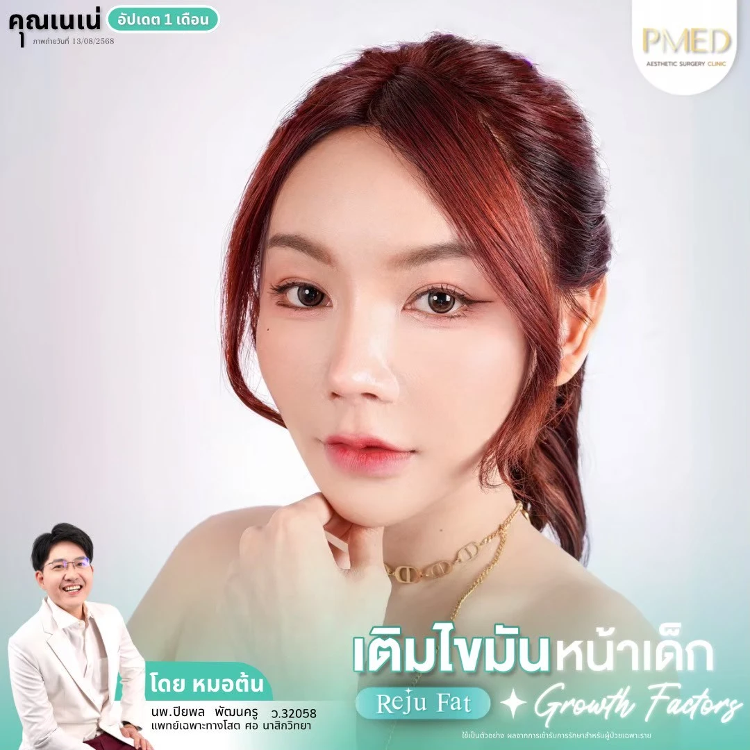 LINE_ALBUM_เติมไขมัน Reju Fat ✨_260715_40
