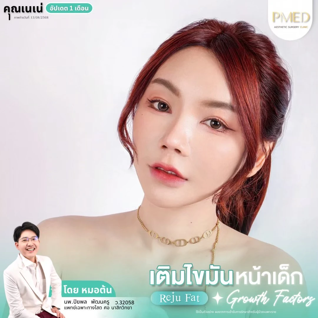 LINE_ALBUM_เติมไขมัน Reju Fat ✨_260715_41