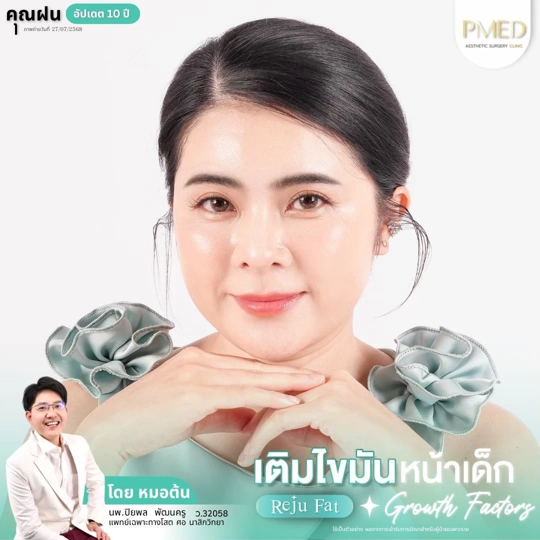 LINE_ALBUM_เติมไขมัน Reju Fat ✨_260715_42