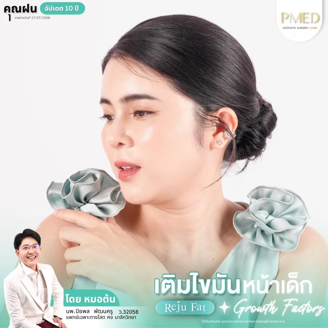 LINE_ALBUM_เติมไขมัน Reju Fat ✨_260715_43