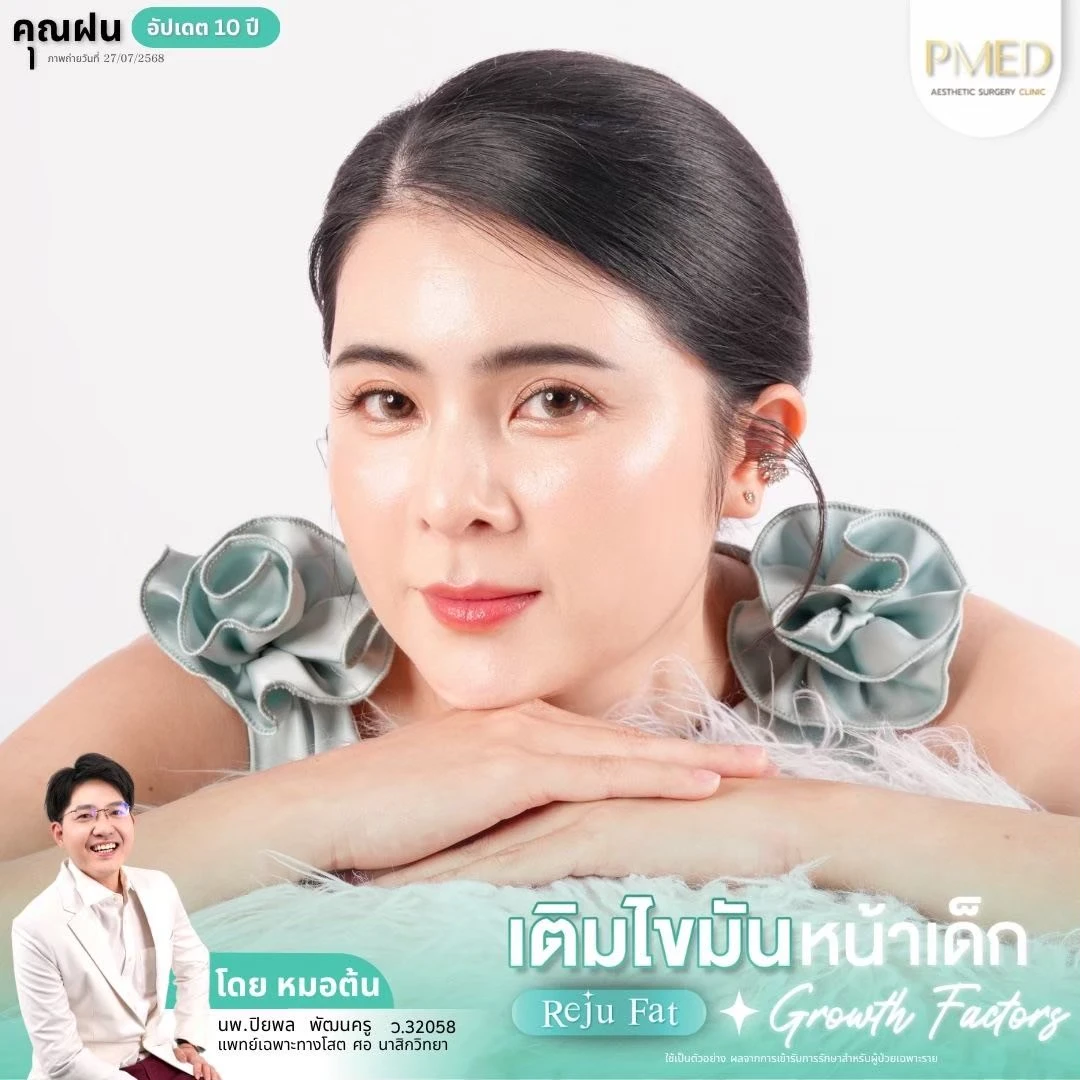 LINE_ALBUM_เติมไขมัน Reju Fat ✨_260715_44