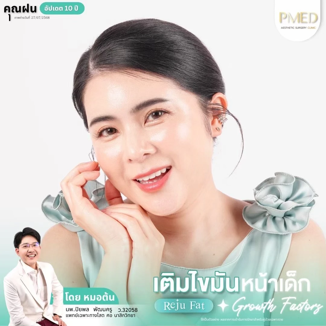 LINE_ALBUM_เติมไขมัน Reju Fat ✨_260715_45