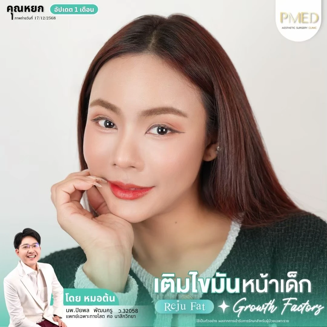 LINE_ALBUM_เติมไขมัน Reju Fat ✨_260715_46