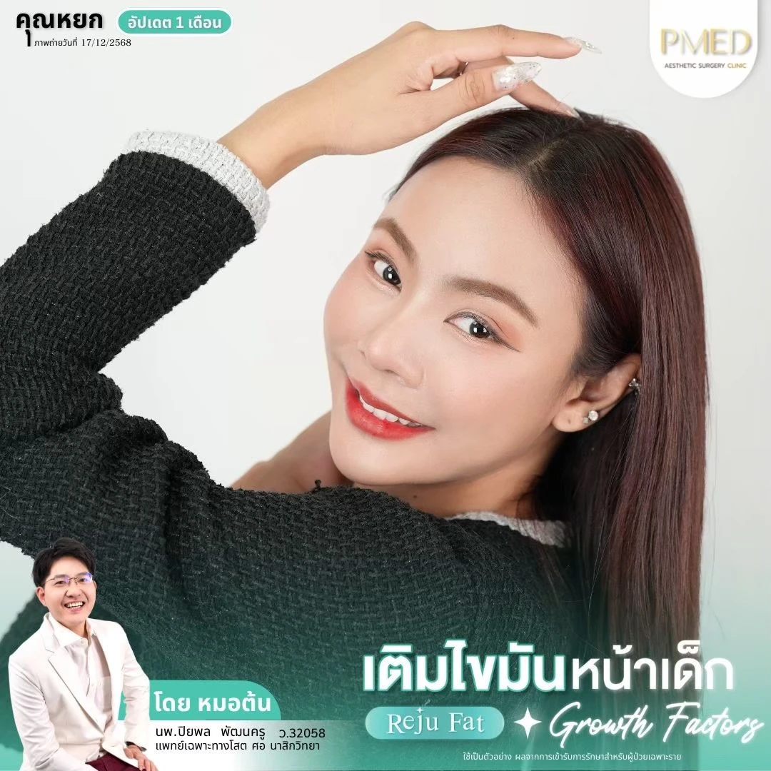 LINE_ALBUM_เติมไขมัน Reju Fat ✨_260715_47