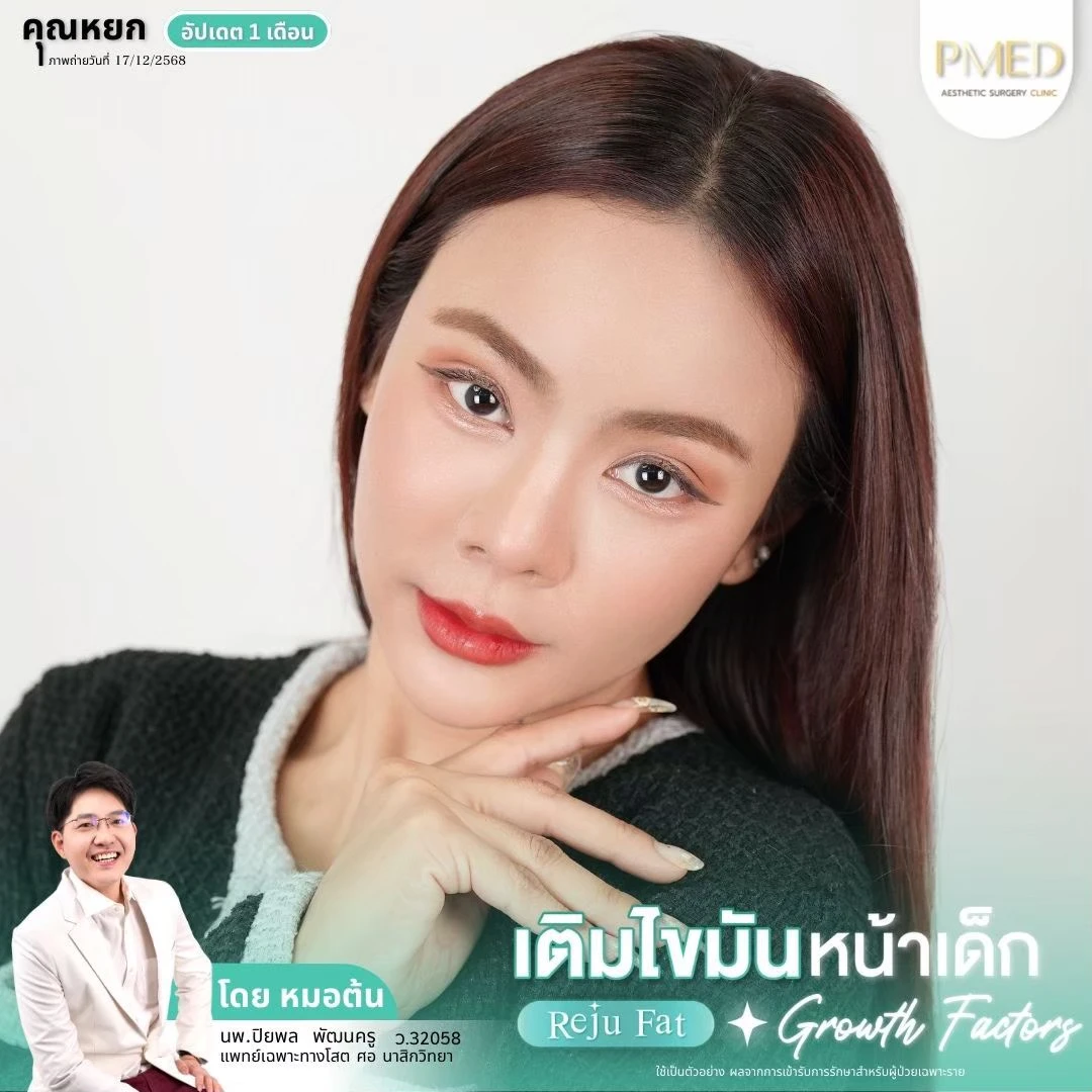 LINE_ALBUM_เติมไขมัน Reju Fat ✨_260715_48