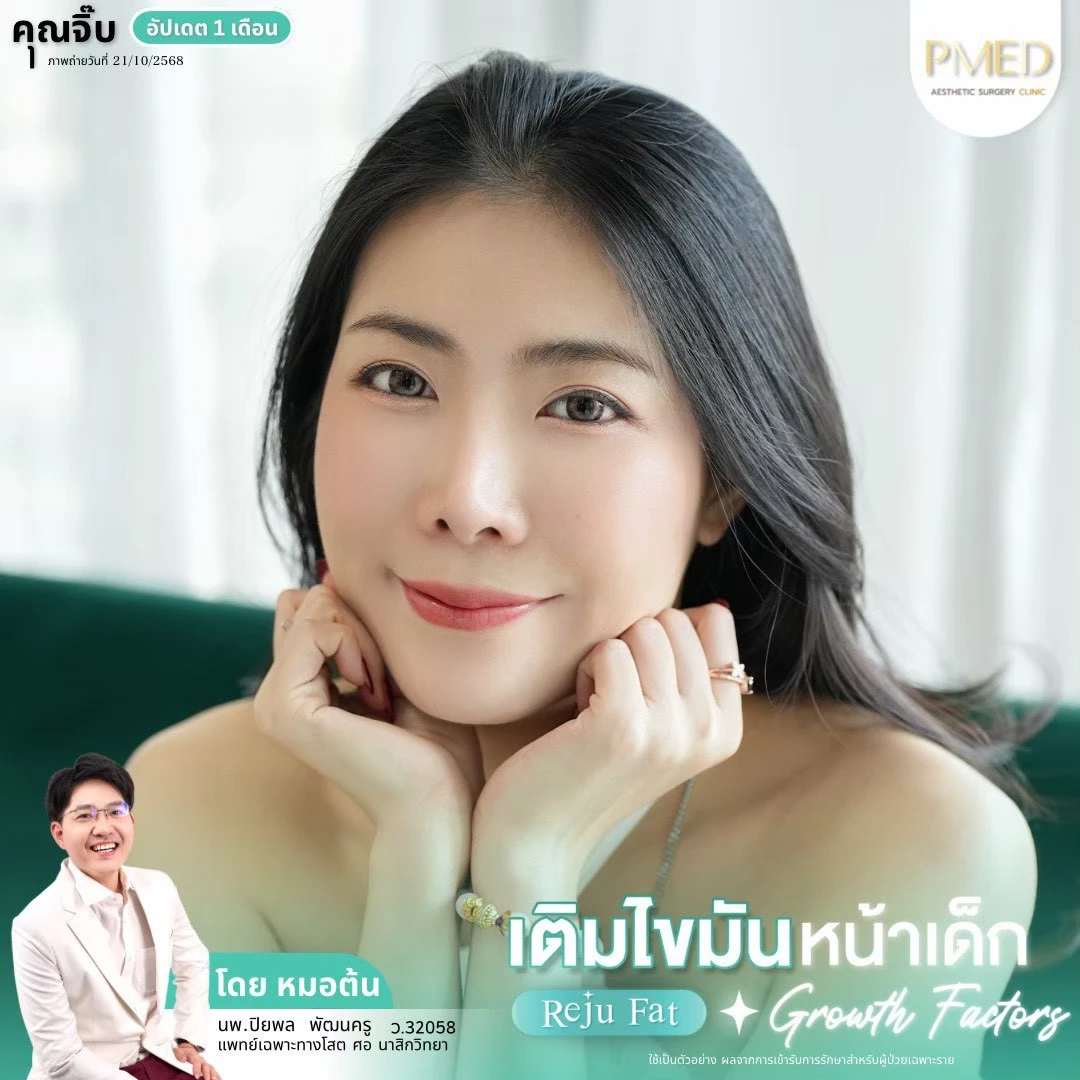 LINE_ALBUM_เติมไขมัน Reju Fat ✨_260715_51