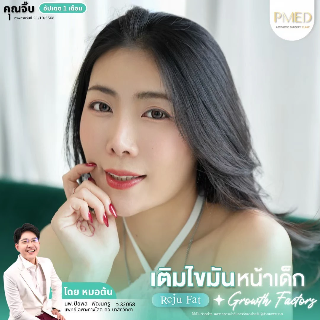 LINE_ALBUM_เติมไขมัน Reju Fat ✨_260715_52