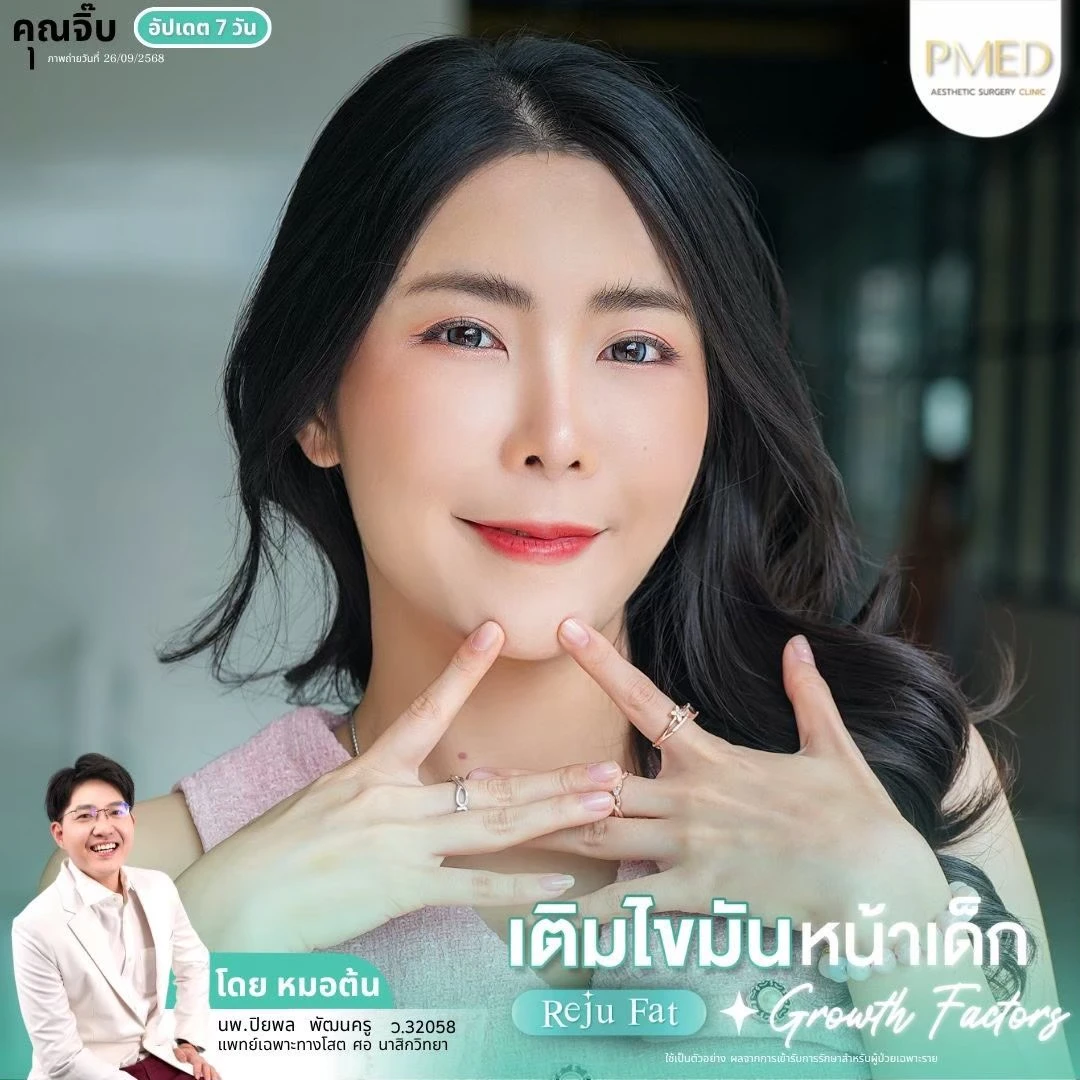 LINE_ALBUM_เติมไขมัน Reju Fat ✨_260715_55