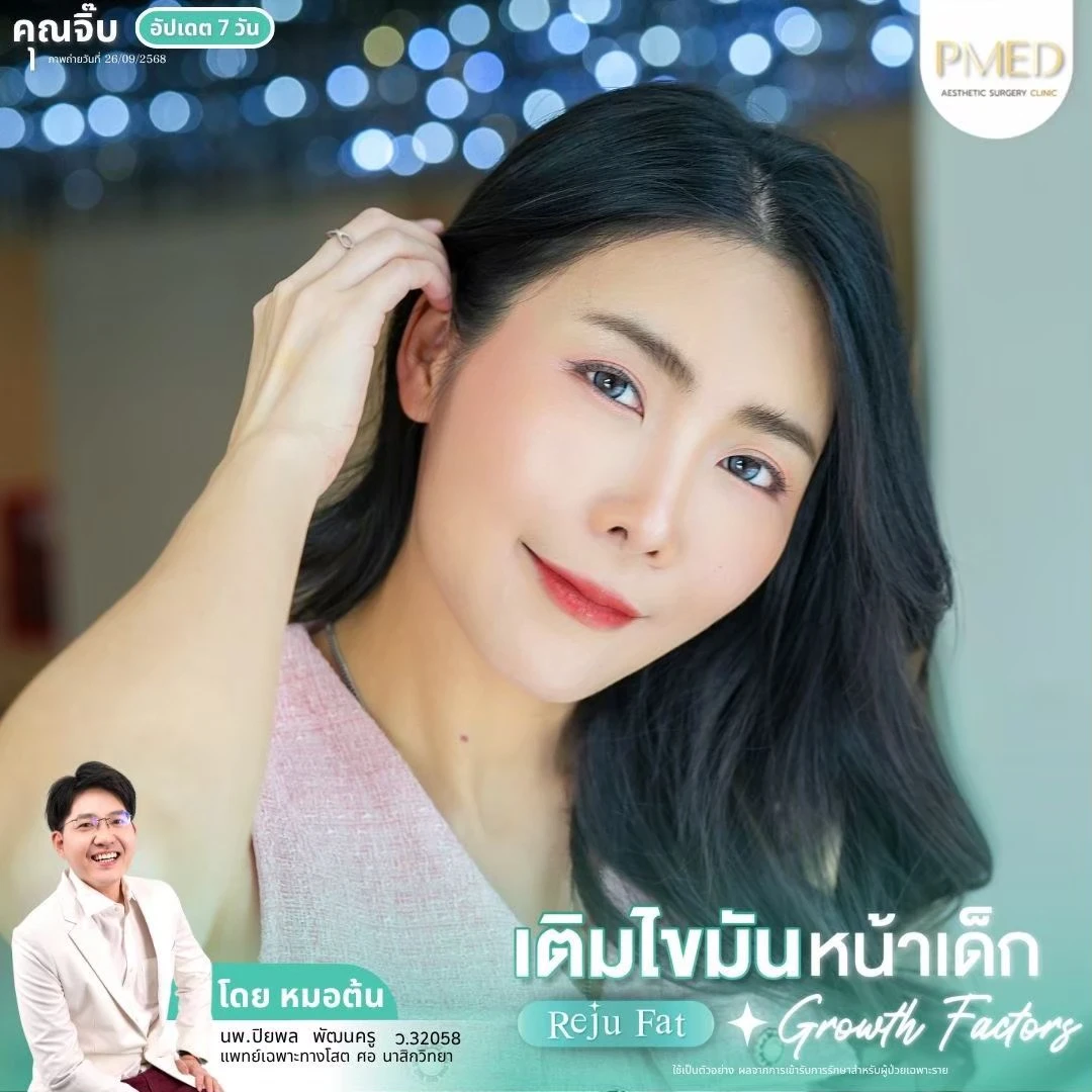 LINE_ALBUM_เติมไขมัน Reju Fat ✨_260715_56