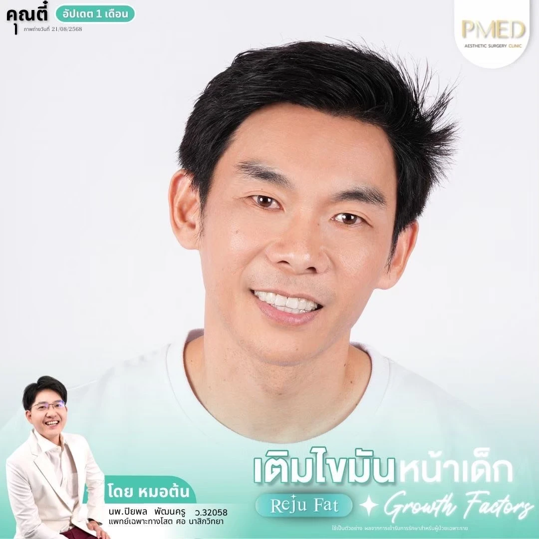 LINE_ALBUM_เติมไขมัน Reju Fat ✨_260715_61