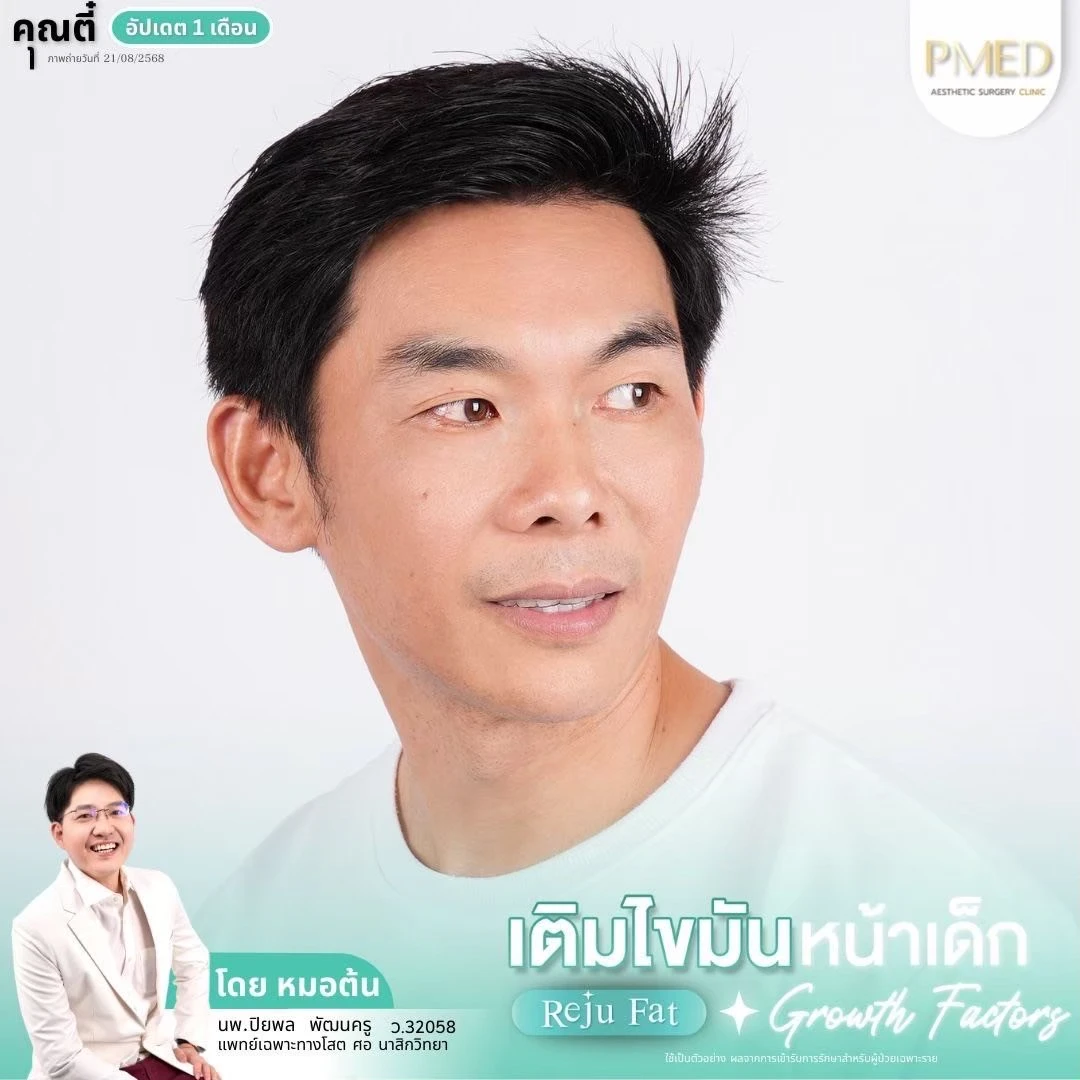 LINE_ALBUM_เติมไขมัน Reju Fat ✨_260715_62