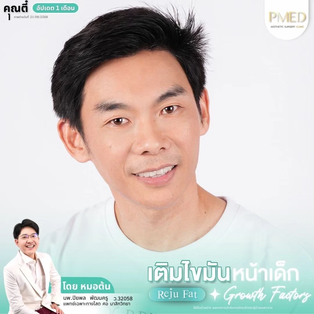 LINE_ALBUM_เติมไขมัน Reju Fat ✨_260715_63