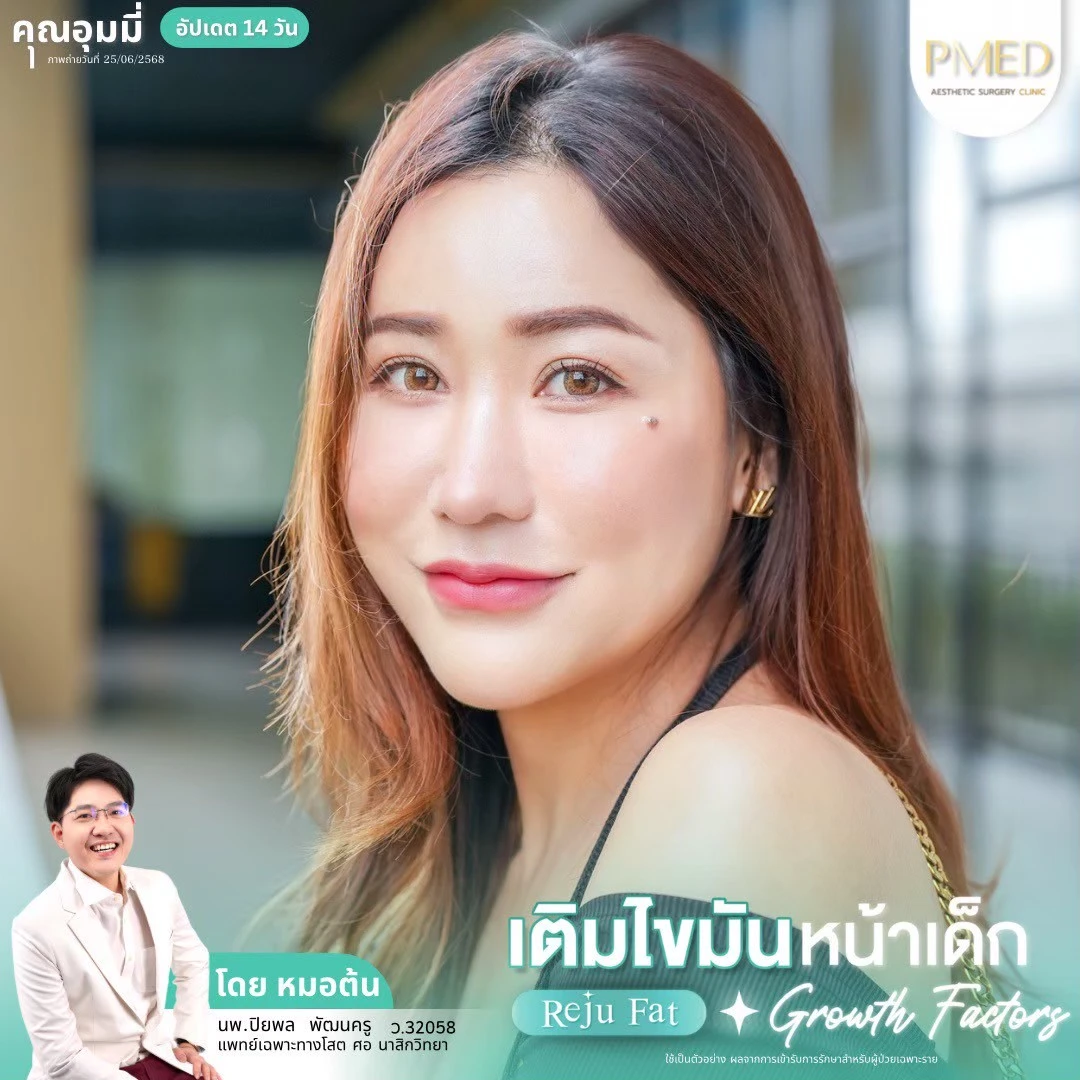 LINE_ALBUM_เติมไขมัน Reju Fat ✨_260715_72