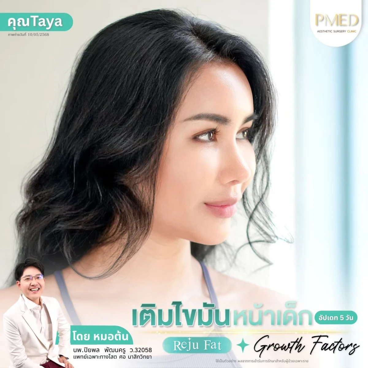 LINE_ALBUM_เติมไขมัน Reju Fat ✨_260715_73