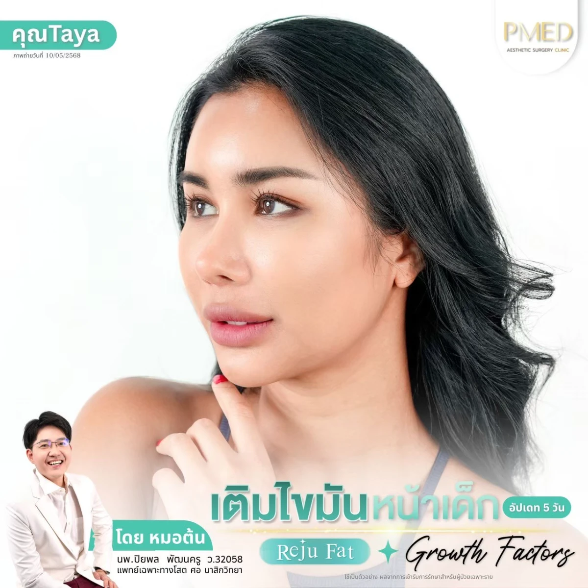 LINE_ALBUM_เติมไขมัน Reju Fat ✨_260715_75