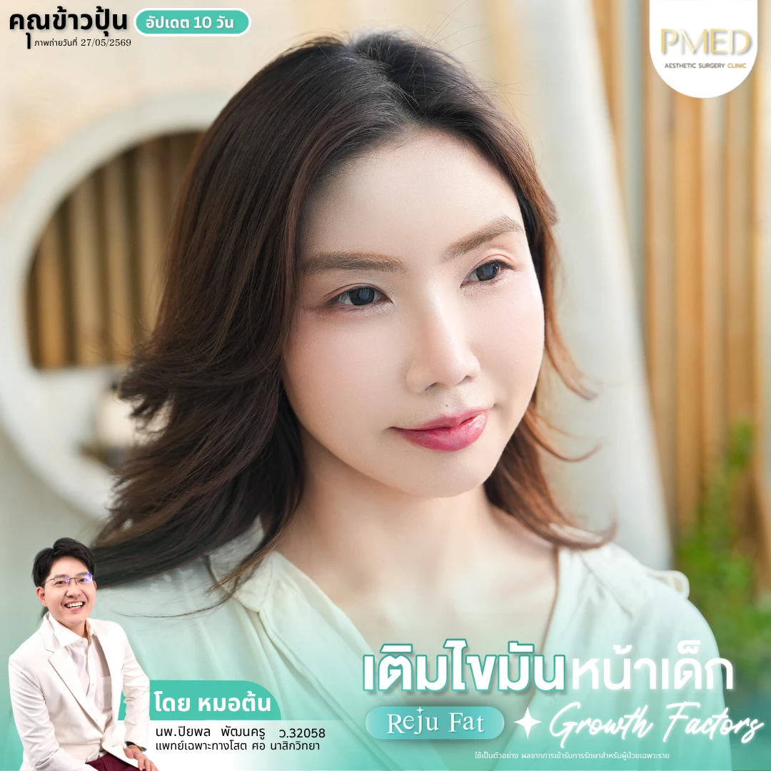 เติมไขมัน (10)