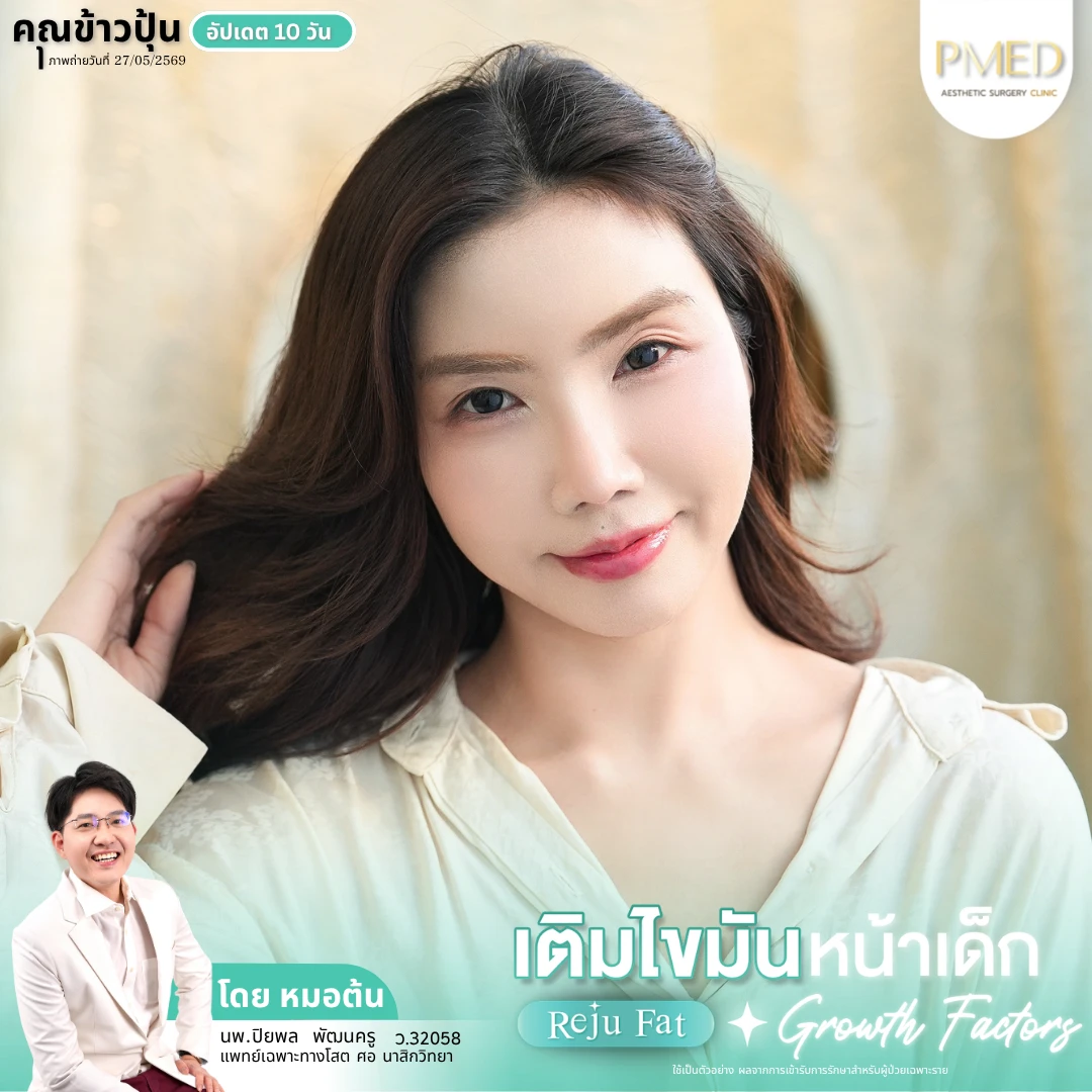 เติมไขมัน (11)