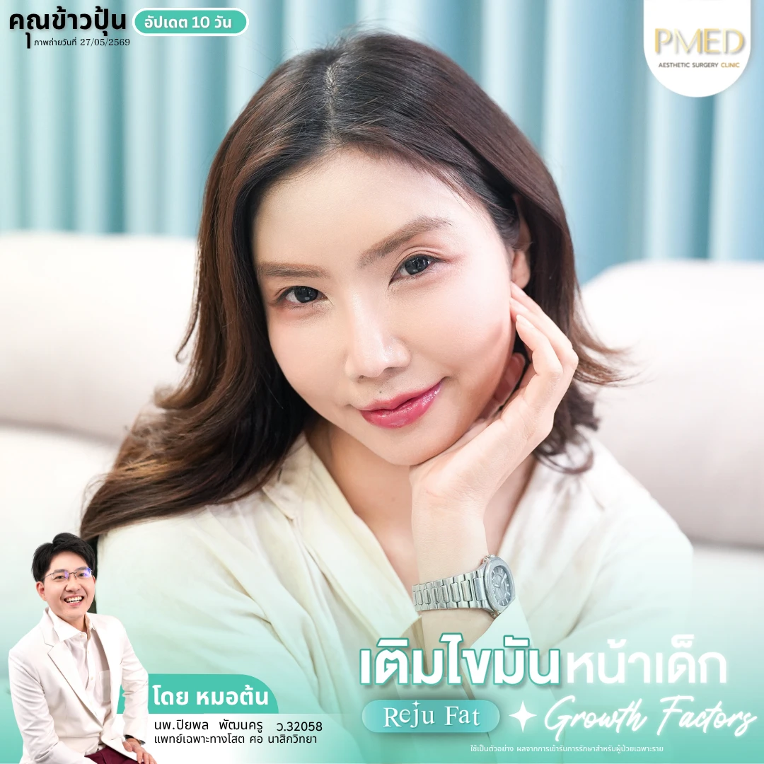 เติมไขมัน (2)