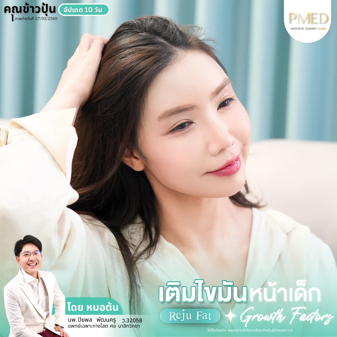เติมไขมัน (4)