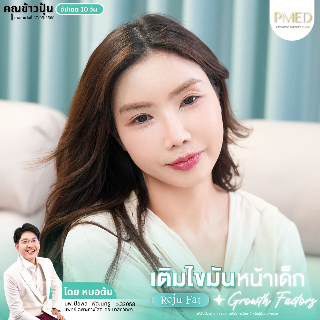 เติมไขมัน (5)