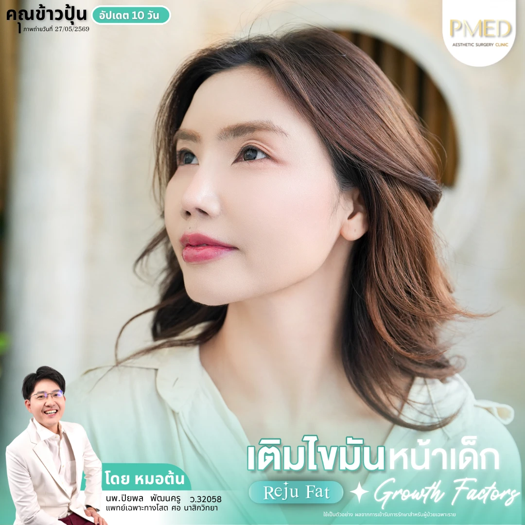 เติมไขมัน (6)