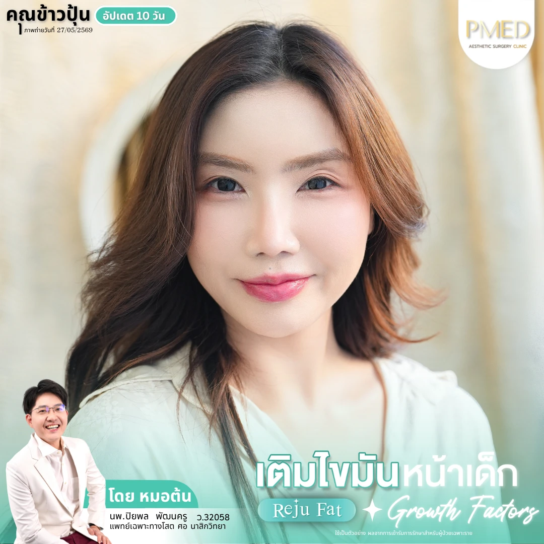 เติมไขมัน (7)