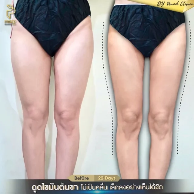 S__18538533