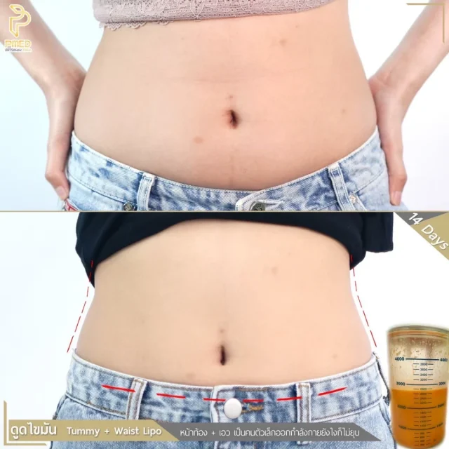 S__18538538